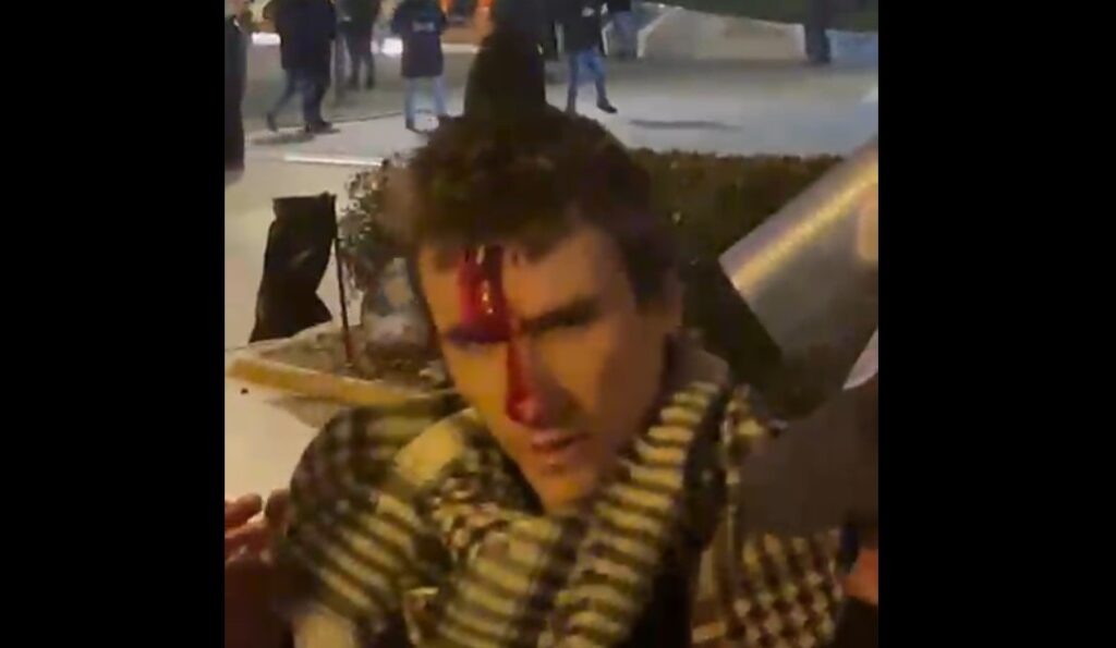 povredjeniii