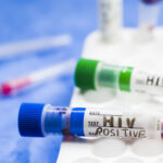 Selective focus of positive HIV blood specimen on test tube in the laboratory