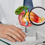 Diagnosis and treatment of pancreatic disease. Doctor consulting patient with acute pancreatitis patient pointing out pancreatic disease on anatomical model