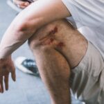 wounded-leg-and-arm-after-fall-2026-03-24-07-49-15-utc