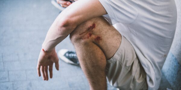 wounded-leg-and-arm-after-fall-2026-03-24-07-49-15-utc
